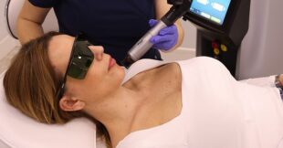 Manje je više: Trend prirodnog podmlađivanja uz Nano Q laser (foto: Andreja Damnjanović)