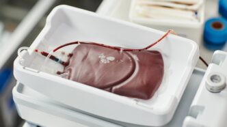Institut za transfuziju krvi Srbije (ITKS): dobrovoljno davanje krvi (foto: DepositPhotos.com)